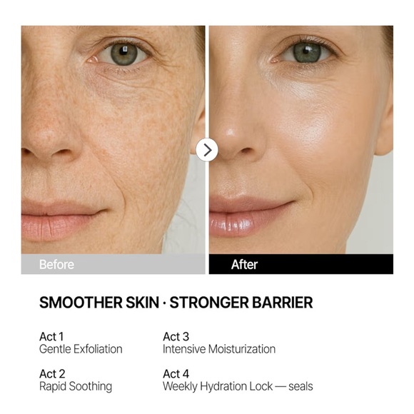 THOME G-Peel One-Day Program - Picture 12 of 14